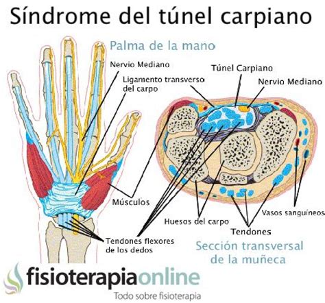 Carpiano .